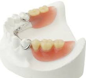 Phục hình tháo lắp