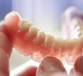 Phục hình răng tháo lắp