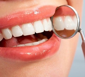 Trám răng thẩm mỹ